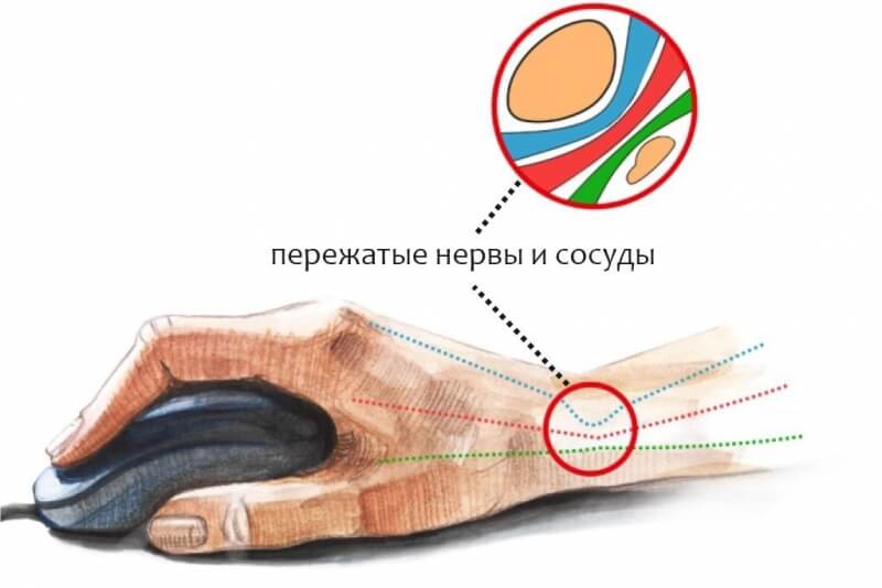 Что такое кракен в интернете